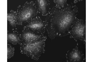 Immunofluorescent staining of A549 cells. (FAK 抗体  (pTyr397))