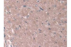 Detection of ASPN in Mouse Cerebrum Tissue using Polyclonal Antibody to Asporin (ASPN) (Asporin 抗体  (AA 16-373))