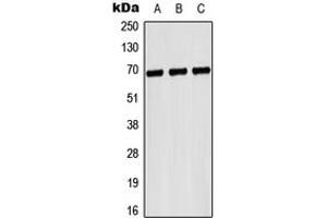 Western blot analysis of CD42b expression in Hela (A), NIH3T3 (B), H9C2 (C) whole cell lysates. (CD42b 抗体  (Center))