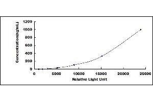 Vitamin D-Binding Protein (GC) CLIA Kit