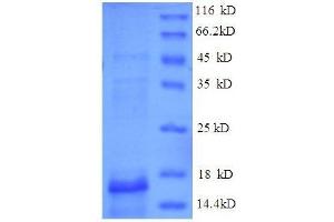 SDS-PAGE (SDS) image for Oncomodulin (OCM) (AA 1-113) protein (His tag) (ABIN1667677)