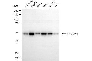 anti-Protein Kinase C and Casein Kinase Substrate in Neurons 3 (PACSIN3) antibody