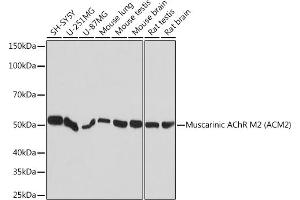 Western blot analysis of extracts of various cell lines, using Muscarinic AChR M2 (Muscarinic AChR M2 ) Rabbit mAb (ABIN7266346) at 1:1000 dilution. (Muscarinic Acetylcholine Receptor M2 抗体)