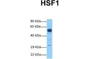 Host:  Rabbit  Target Name:  HSF1  Sample Tissue:  Human Fetal Brain  Antibody Dilution:  1. (HSF1 抗体  (C-Term))