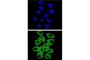 Confocal immunofluorescent analysis of CITED2 Antibody (C-term) (ABIN654133 and ABIN2844005) with Hela cell followed by Alexa Fluor® 489-conjugated goat anti-rabbit lgG (green). (CITED2 抗体  (C-Term))