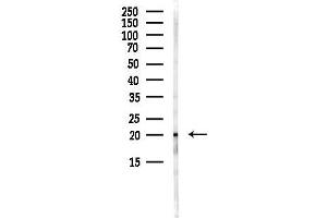 anti-Tumor Protein, Translationally-Controlled 1 (TPT1) (Internal Region) antibody