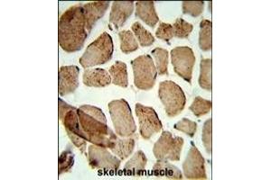 Formalin-fixed and paraffin-embedded human skeletal muscle reacted with Denatured ATG1 Antibody, which was peroxidase-conjugated to the secondary antibody, followed by DAB staining. (Denatured ATG1 抗体)