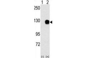Western Blotting (WB) image for anti-TYRO3 Protein Tyrosine Kinase (TYRO3) antibody (ABIN3003422) (TYRO3 抗体)
