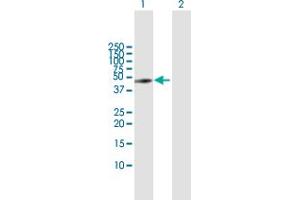 Western Blot analysis of GART expression in transfected 293T cell line by GART MaxPab polyclonal antibody. (GART 抗体  (AA 1-433))