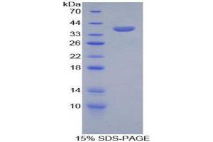 SDS-PAGE (SDS) image for serine Peptidase Inhibitor, Kazal Type 1 (SPINK1) (AA 26-78) protein (His tag,GST tag) (ABIN1879830) (SPINK1 Protein (AA 26-78) (His tag,GST tag))