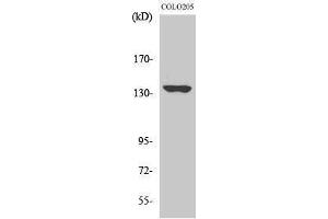 Western Blotting (WB) image for anti-MN1 proto-oncogene (MN1) (Internal Region) antibody (ABIN3185603) (Meningioma 1 抗体  (Internal Region))