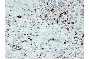 Immunohistochemistry (IHC) image for anti-Peptidyl Arginine Deiminase, Type IV (PADI4) antibody (ABIN2728127)