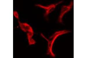 Immunofluorescence (fixed cells) (IF/ICC) image for anti-Proteasome (Prosome, Macropain) 26S Subunit, Non-ATPase, 3 (PSMD3) (C-Term) antibody (ABIN6259043)