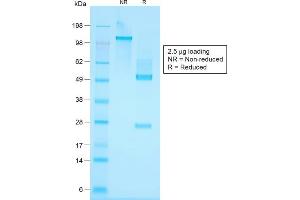 SDS-PAGE Analysis Purified Cytokeratin, HMW Rabbit Recombinant Monoclonal Antibody (KRTH/1576R). (Recombinant Cytokeratin 2 抗体)