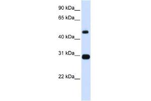WB Suggested Anti-PSMC3 Antibody Titration: 0. (PSMC3 抗体  (N-Term))