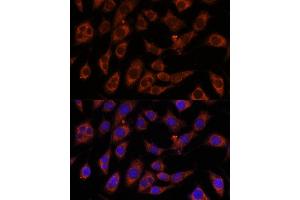 Immunofluorescence analysis of L929 cells using GFPT2 antibody (ABIN7267431) at dilution of 1:100. (GFPT2 抗体  (AA 200-260))