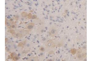 Detection of FABP1 in Human Liver Tissue using Polyclonal Antibody to Fatty Acid Binding Protein 1 (FABP1) (FABP1 抗体  (AA 2-127))