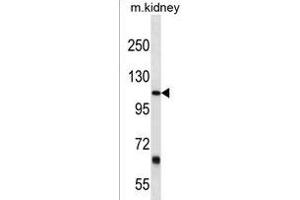 PTGFRN Antibody (Center) (ABIN1538438 and ABIN2849958) western blot analysis in mouse kidney tissue lysates (35 μg/lane). (PTGFRN 抗体  (AA 458-485))