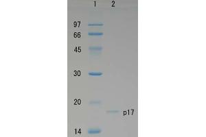 SDS-PAGE (SDS) image for Human Immunodeficiency Virus 1 Matrix (HIV-1 p17) protein (ABIN2452193) (HIV-1 p17 蛋白)