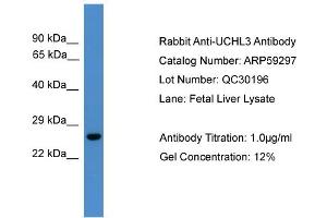 WB Suggested Anti-UCHL3  Antibody Titration: 0. (UCHL3 抗体  (C-Term))