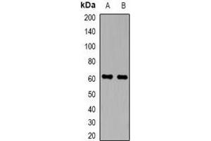 Western blot analysis of Perforin 1 expression in Hela (A), Jurkat (B) whole cell lysates. (Perforin 1 抗体  (C-Term))