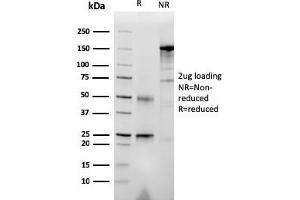 SDS-PAGE Analysis Purified RET Mouse Monoclonal Antibody (RET/2976). (Ret Proto-Oncogene 抗体  (AA 702-848))