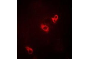 Immunofluorescent analysis of ACAD9 staining in MCF7 cells.