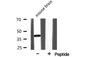 Western blot analysis on mouse brain lysate using NPM Antibody (NPM1 抗体  (N-Term))