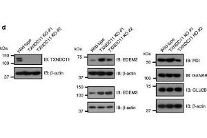 Western Blotting (WB) image for anti-Glucosidase, Alpha, Neutral AB (GANAB) (N-Term) antibody (ABIN2855336)