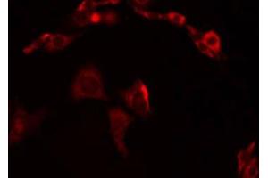 ABIN6274953 staining Hela by IF/ICC. (CHST13 抗体  (Internal Region))