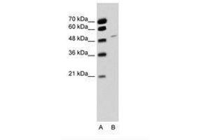 Image no. 1 for anti-RNA Binding Motif Protein 22 (RBM22) (AA 301-350) antibody (ABIN6736326) (RBM22 抗体  (AA 301-350))