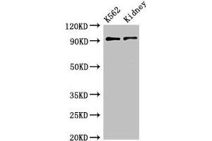 Western Blot Positive WB detected in:K562 whole cell lysate,Mouse kidney tissue All lanes:AP1G1 antibody at 3. (gamma 1 Adaptin 抗体  (AA 592-686))