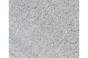 IHC analysis of NEDD4 using anti-NEDD4 antibody (ABIN7599536).