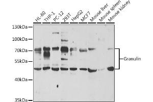 Western blot analysis of extracts of various cell lines, using Granulin antibody (ABIN6131043, ABIN6141430, ABIN6141432 and ABIN6221454) at 1:1000 dilution. (Granulin 抗体  (AA 20-310))