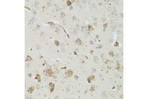 Immunohistochemistry of paraffin-embedded mouse brain using PTPN3 antibody (ABIN5973802) at dilution of 1/100 (40x lens). (PTPN3 抗体)