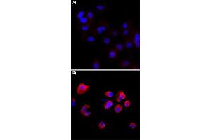 Immunocytochemistry staining of serum-starved A431 cells (A) and serum-starved A431 cells treated with Calyculin A/Okadaic Acid (B) using Phosphothreonine monoclonal antibody, clone RM102  (Red) at 1:500 dilution. (Phosphothreonine 抗体)