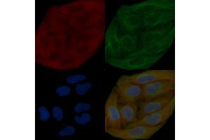 PKC delta Mouse Monoclonal Antibody staining Hela cells by IF/ICC. (PKC delta 抗体  (N-Term))