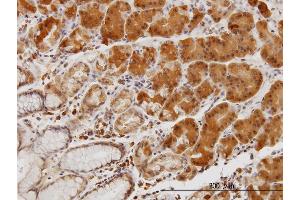 Immunoperoxidase of monoclonal antibody to LIMK1 on formalin-fixed paraffin-embedded human stomach. (LIM Domain Kinase 1 抗体  (AA 548-647))