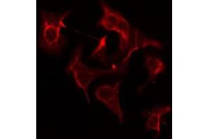ABIN6275202 staining COLO205 cells by IF/ICC. (AASDHPPT 抗体  (C-Term))