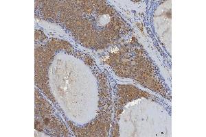 IHC analysis of mSin3A/SIN3A using anti-mSin3A/SIN3A antibody (ABIN7602504). (SIN3A 抗体  (AA 8-918))
