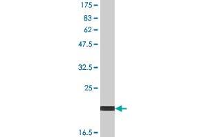 Western Blotting (WB) image for anti-CD40 Ligand (CD40LG) (AA 116-261) antibody (DYKDDDDK Tag,His tag) (ABIN2752648)