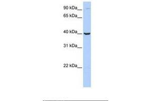 Image no. 1 for anti-Arginase, Type II (ARG2) (C-Term) antibody (ABIN6738956)