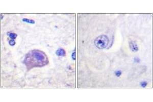 Immunohistochemistry analysis of paraffin-embedded human brain tissue, using HRS (Ab-334) Antibody. (HRS (HRS) (AA 301-350) 抗体)