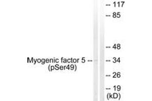 Western blot analysis of extracts from HeLa cells, using Myogenic Factor 5 (Phospho-Ser49) Antibody. (MYF5 抗体  (pSer49))