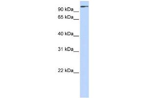 WB Suggested Anti-ZNF175 Antibody Titration:  0. (ZNF175 抗体  (C-Term))