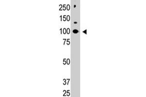 Western blot analysis of CBLC polyclonal antibody  in HL-60 cell lysate. (CBLC 抗体  (C-Term))