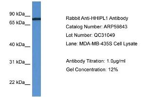 WB Suggested Anti-HHIPL1  Antibody Titration: 0. (HHIPL1 抗体  (C-Term))