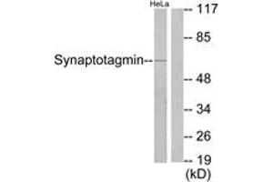 Western Blotting (WB) image for anti-Synaptotagmin (SYT) (AA 176-225) antibody (ABIN2888581) (Synaptotagmin 抗体  (AA 176-225))