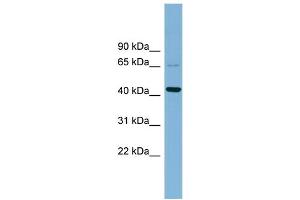 WB Suggested Anti-UEVLD  Antibody Titration: 0. (UEVLD 抗体  (Middle Region))