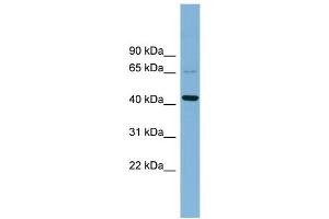 WB Suggested Anti-UEVLD  Antibody Titration: 0.